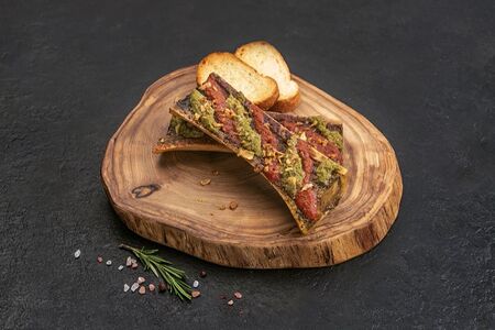 Мозговые кости