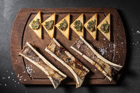 Костный мозг