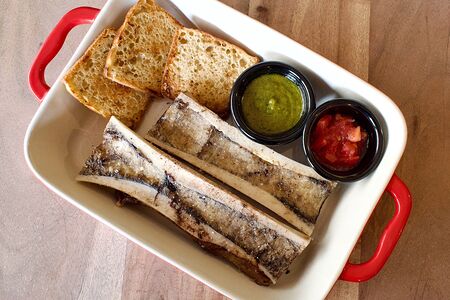 Мозговые кости